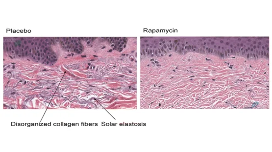 Rapamycin skin