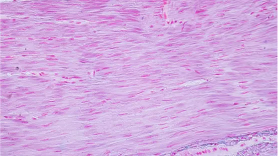 Microscope image of smooth muscle cells