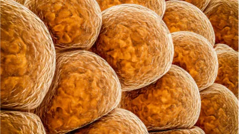 A picture of brown fat cells