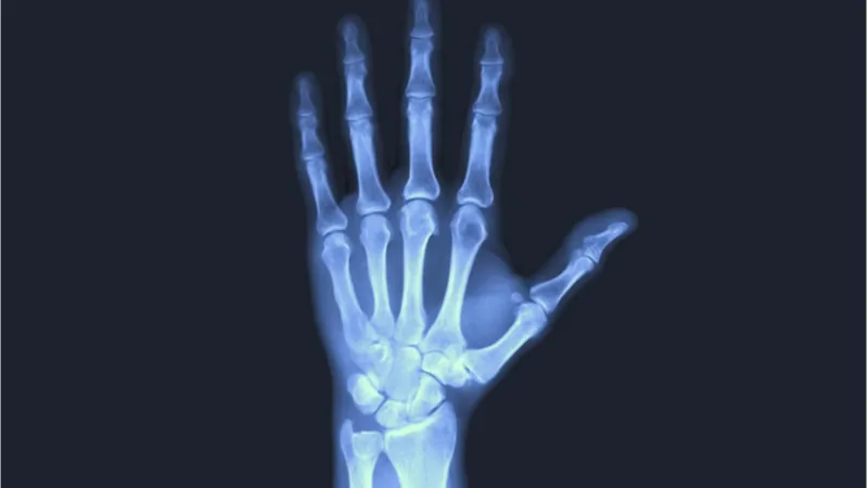 X-ray hand