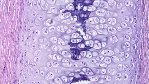 Cartilage cells