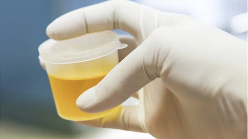 urine test