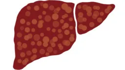 Fibrotic liver