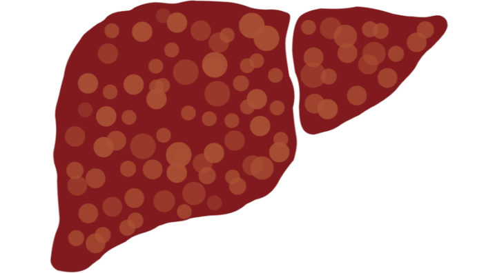 Fibrotic liver