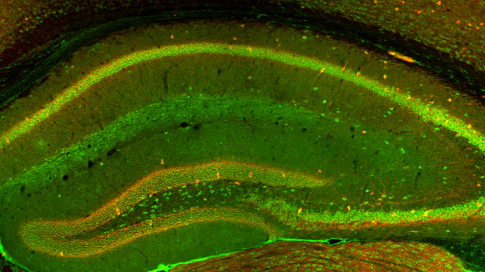 Mouse Brain Internal
