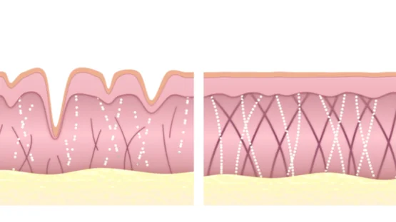 Old and young collagen