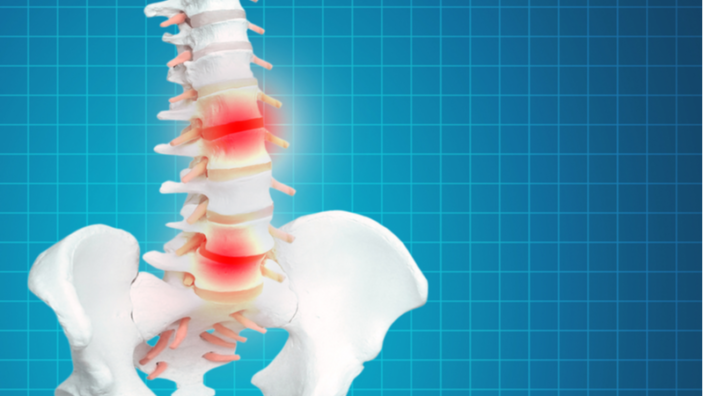 Spinal Disc Degeneration