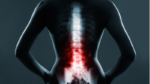 Spinal Injury