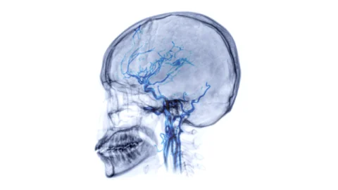 brain vasculature