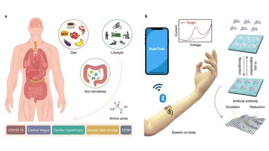 wearable device