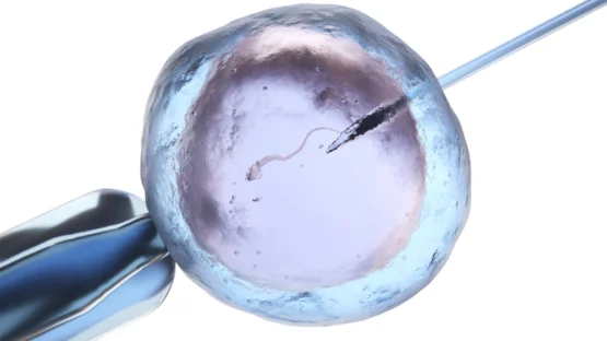 In vitro fertilization