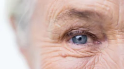 Elderly eye