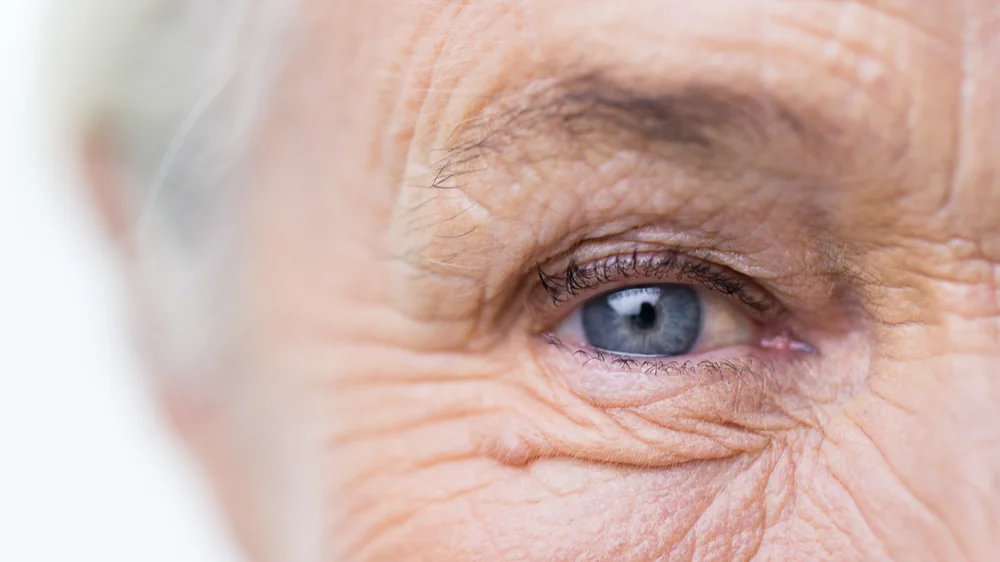 Elderly eye