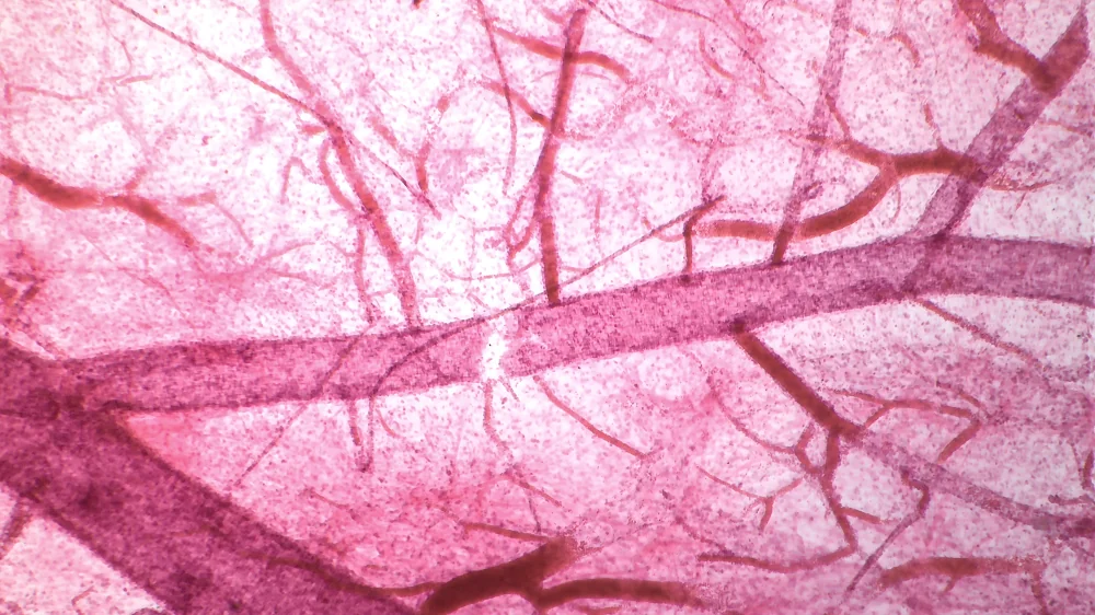 Capillaries