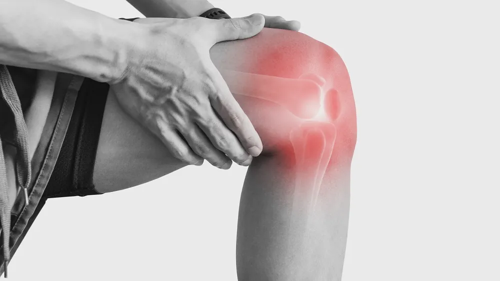 Knee arthritis