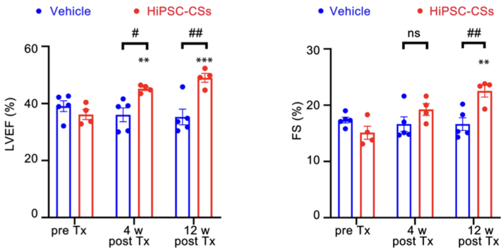 iPSC Cardiomyocytes
