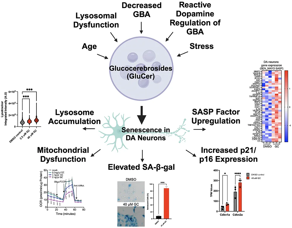 GBA Senescence Parkinson's