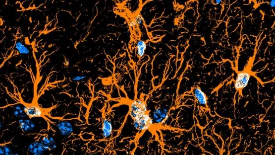 Astrocytes