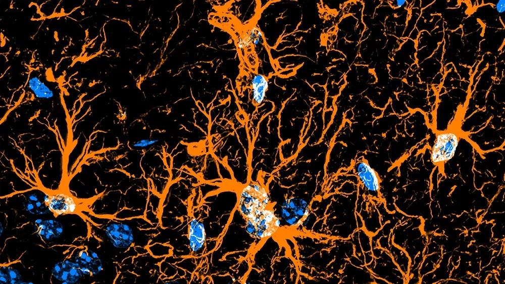 Astrocytes