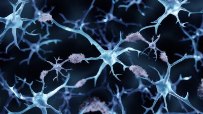 Protein aggregates on neurons