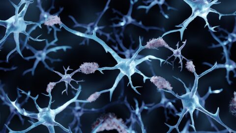 Protein aggregates on neurons