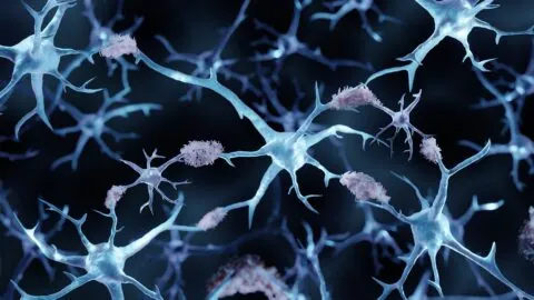 Protein aggregates on neurons