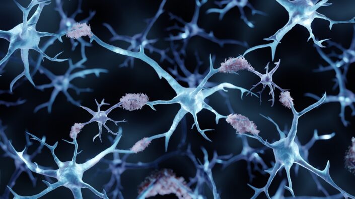 Protein aggregates on neurons