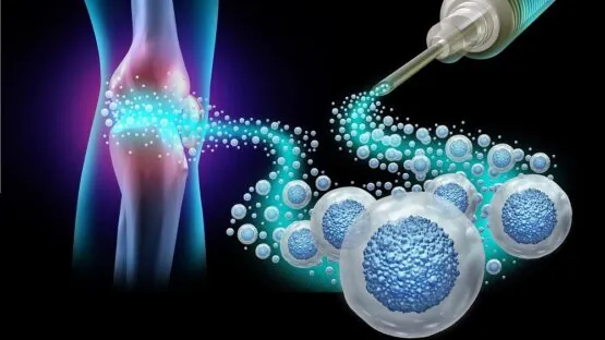 Vesicles for joints