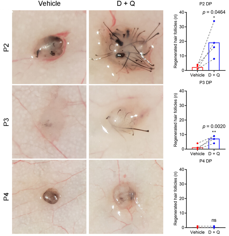 Hair growth senolytics