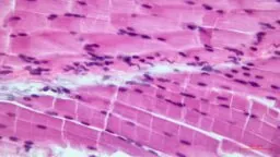 Skeletal muscle