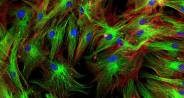 A Protein That Controls Senescent Cell Structure