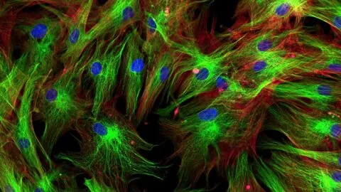 Fibroblasts