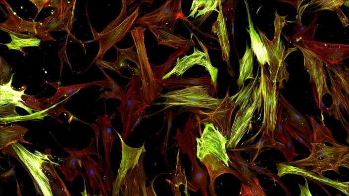 Lung fibroblasts