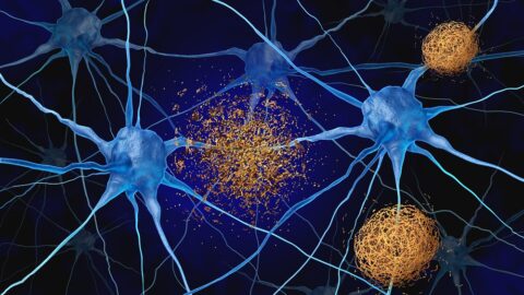Amyloids between neurons