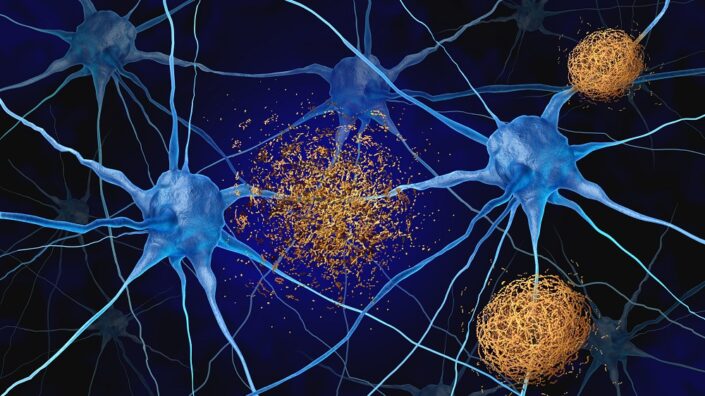 Amyloids between neurons