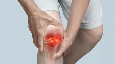 Knee arthritis