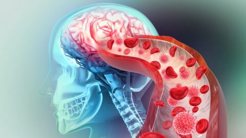 Blood vessel in brain