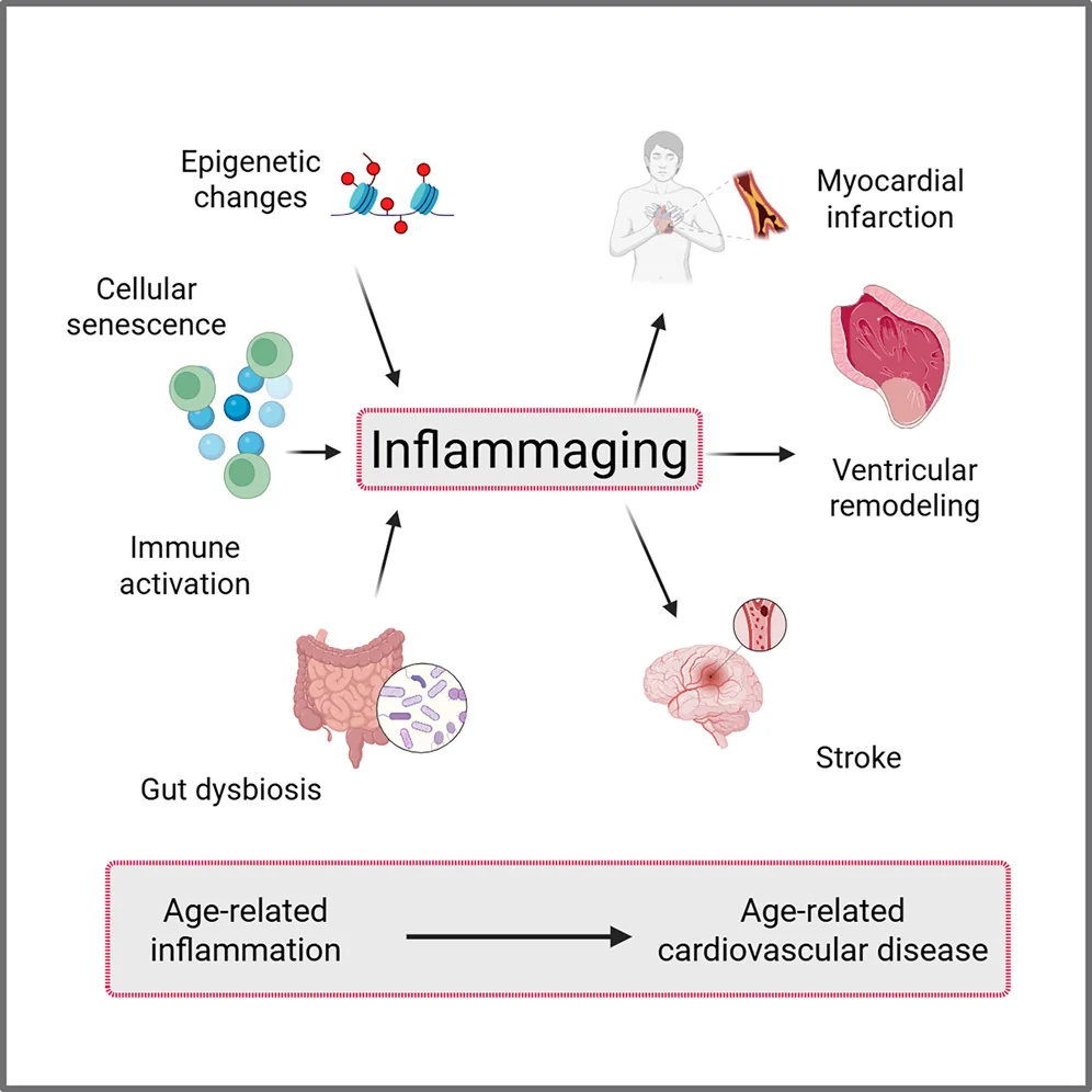 Cardiovascular Inflammaging