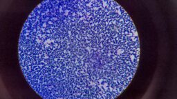 Bacteria under microscope