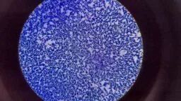 Bacteria under microscope