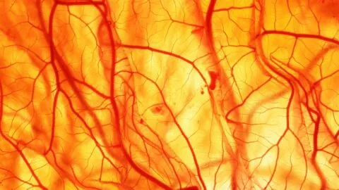 Blood vessels