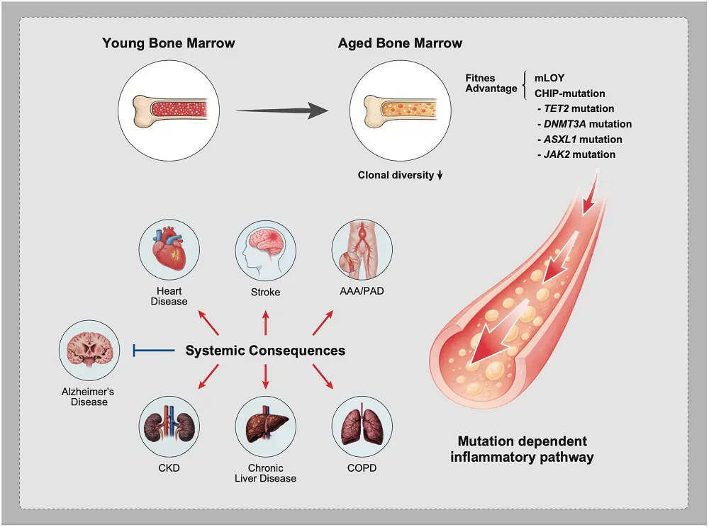 Bone marrow aging consequences