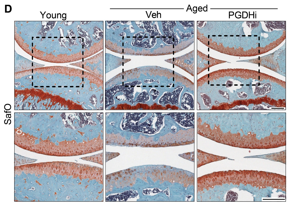 Cartilage condition PGDHi