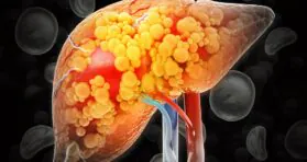 Study Uncovers How Obesity Drives Chronic Inflammation