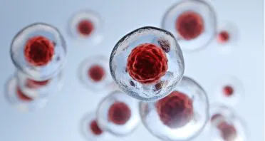 A Metabolic Shift Fuels Stem Cell Dysfunction