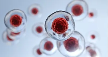 A Metabolic Shift Fuels Stem Cell Dysfunction