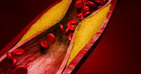 The Many Dangers of 7-Ketocholesterol