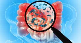 Study Links a Gut Bacterium to Increased Muscle Strength