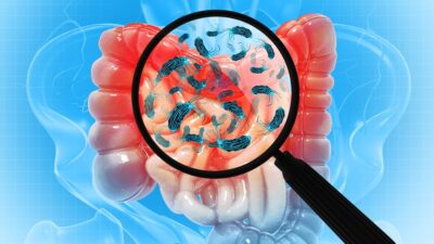 Finding gut bacteria
