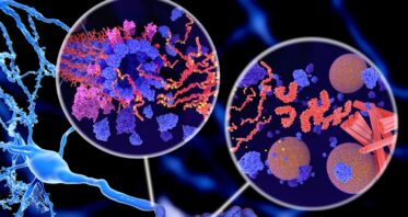 Using mRNA to Fight Tau Aggregation in Alzheimer’s